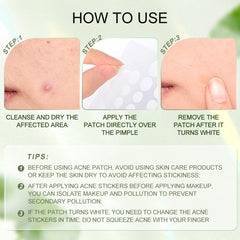 SACE LADY Waterproof Acne Patches – Effective Acne Removal, Anti-Inflammatory & Soothing (36PCS)