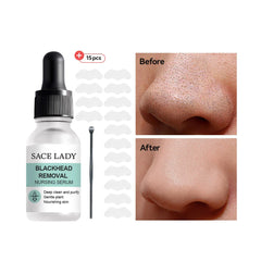 SACE LADY Blackhead Remover Serum – Gentle Deep Cleansing Pore Serum with 100% Organic Ingredients