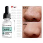 Blackhead Remover Serum Gentle Deep Cleansing Pore